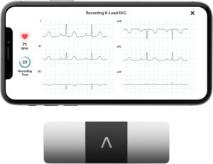AliveCor KardiaMobile 6