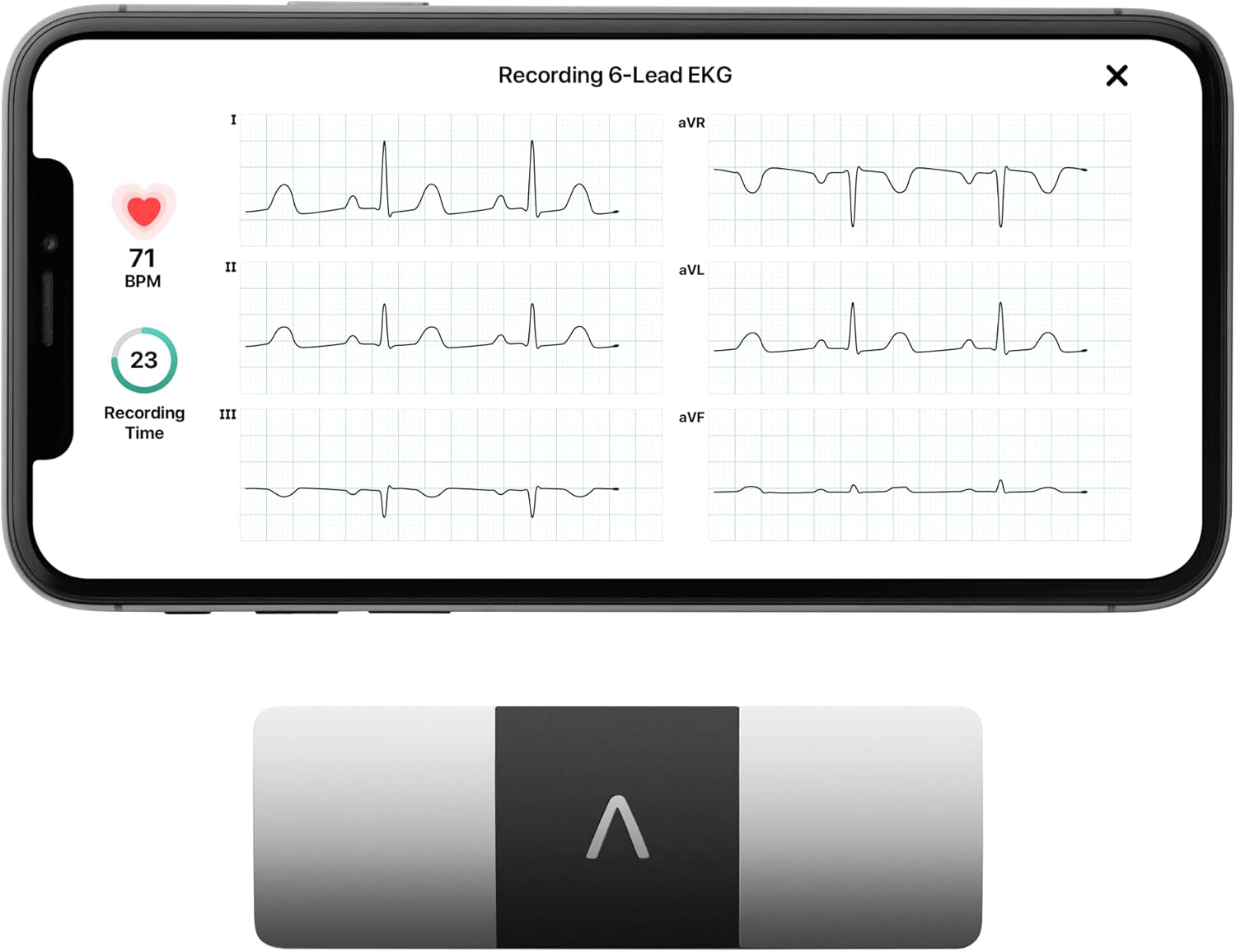 AliveCor KardiaMobile 6